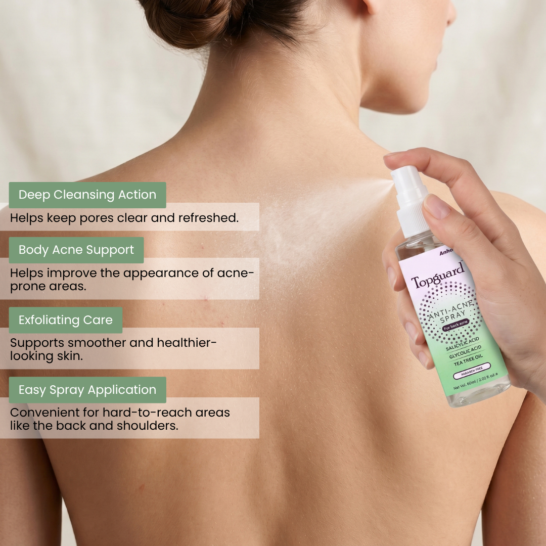 Topguard Anti Acne Spray