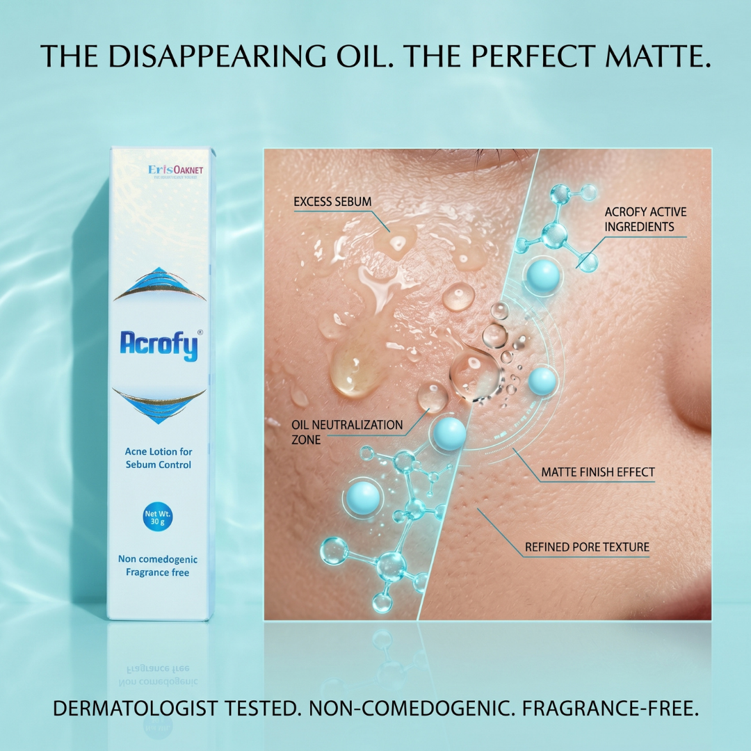 Acrofy Acne Lotion for Sebum Control