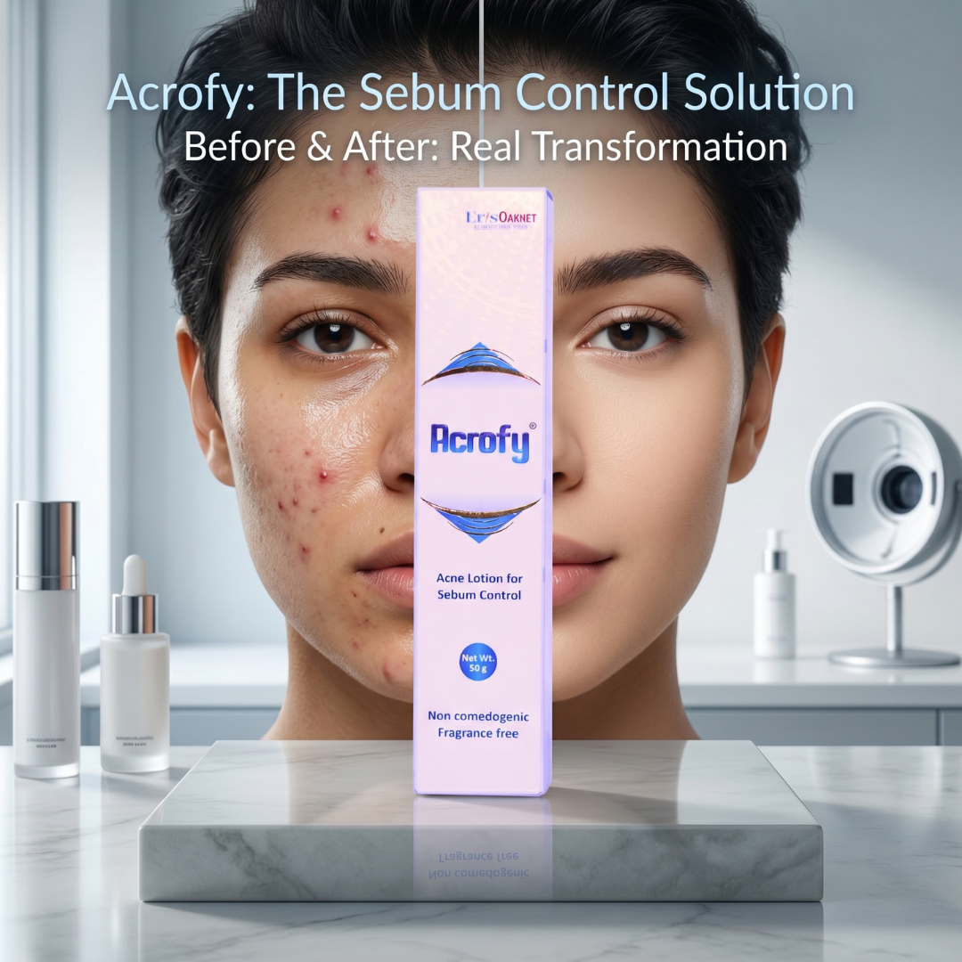 Acrofy Acne Lotion for Sebum Control