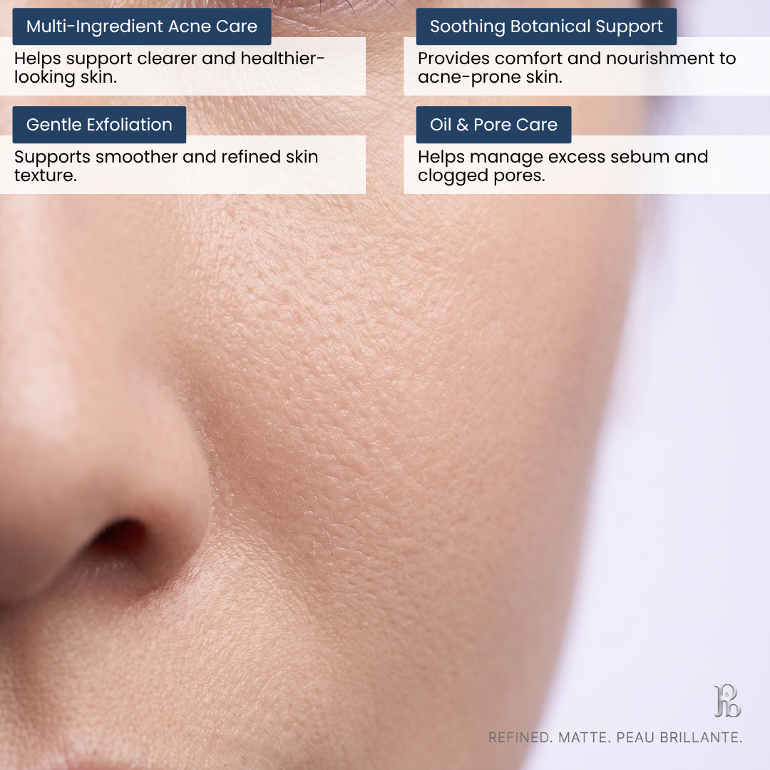 AgePause Azelaic Acid Acne Gel Face Serum