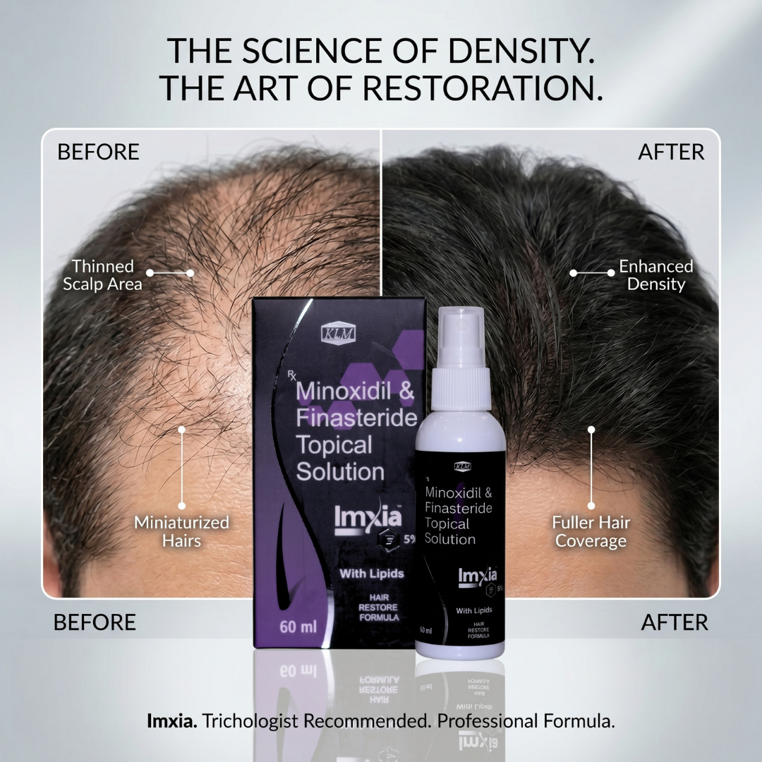 Imxia 5% Hair Restore Formula