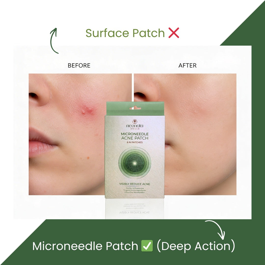 Neonata Belle Acne Patch 6 Dots