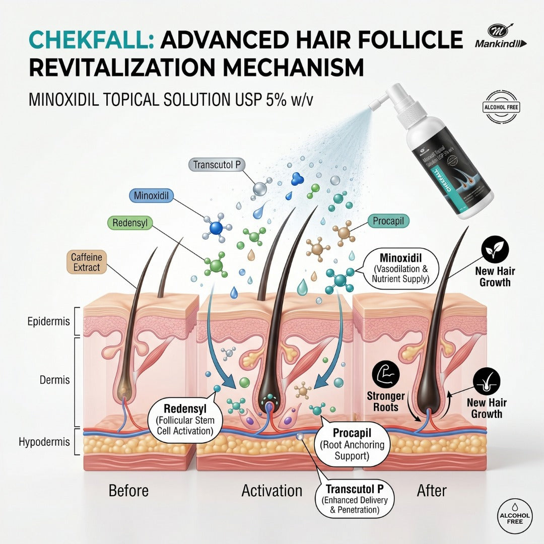 Chekfall 5 Solution