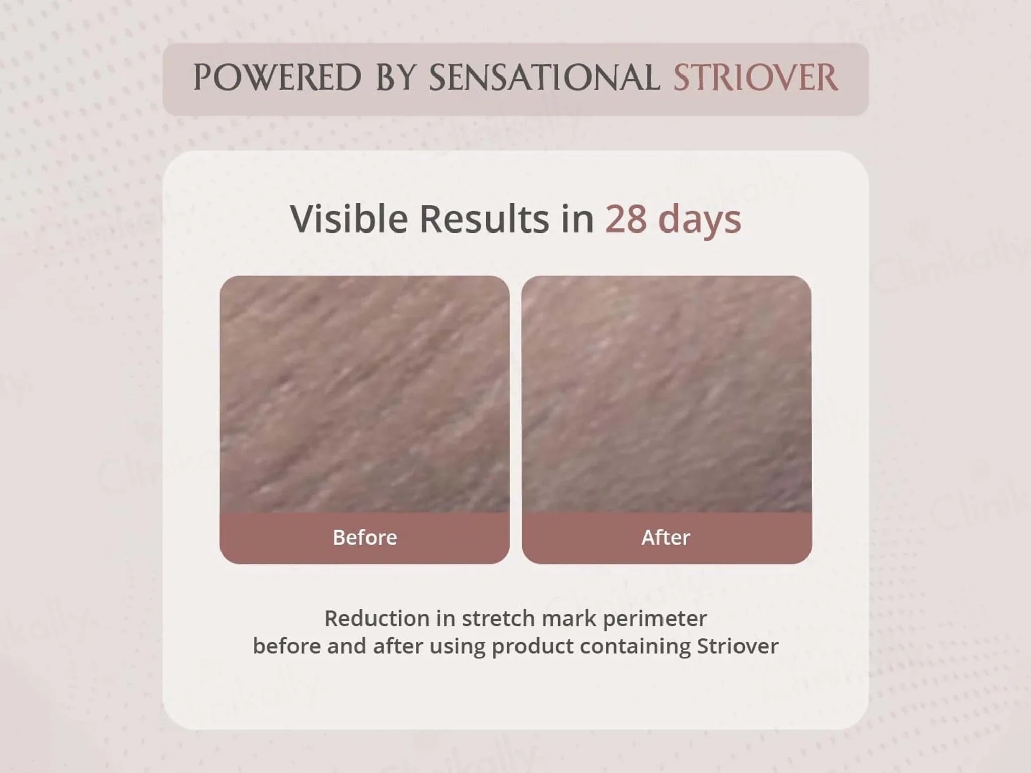 Areoveda Stretch Marks Cream - Atomic Pharmacy