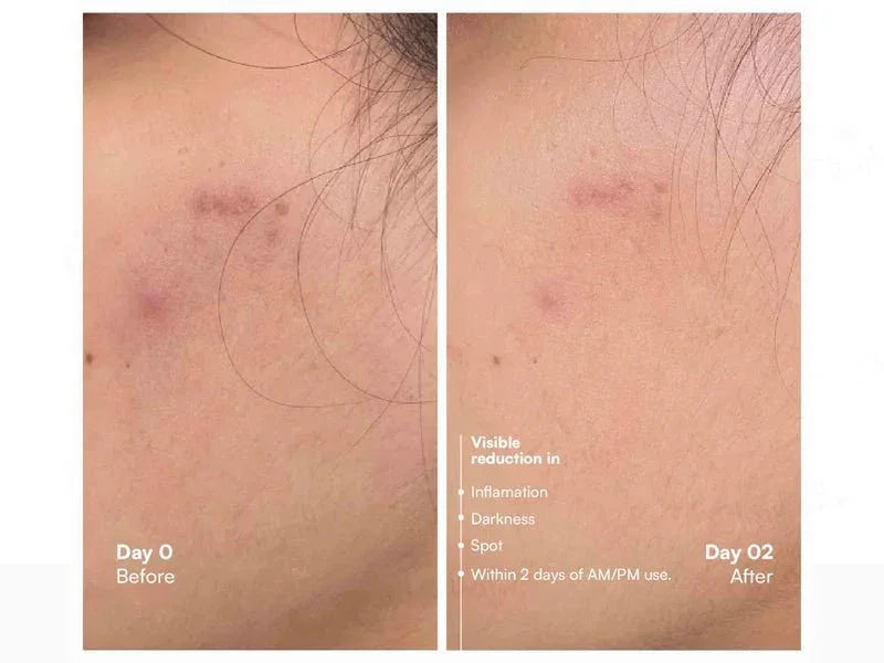 Awear Beauty Glass Skin Dual Spot Treatment Serum - Atomic Pharmacy