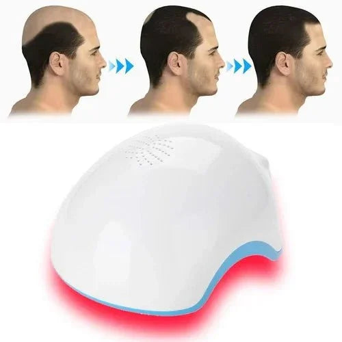 Laser Hair Growth Helmet – A Smarter Way to Regrow Your Hair - Atomic Pharmacy