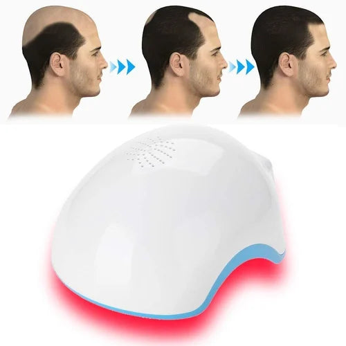 Laser Hair Growth Helmet | Advanced Hair Rejuvenation Device