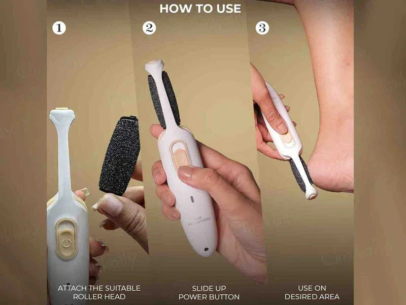Winston Callus Remover - Atomic Pharmacy