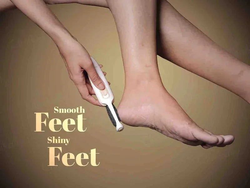 Winston Callus Remover - Atomic Pharmacy